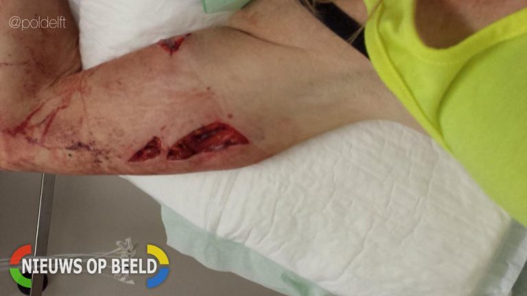Vrouw ernstig gewond na beet van Rottweiler, eigenaar spoorloos Hoflaan Delft