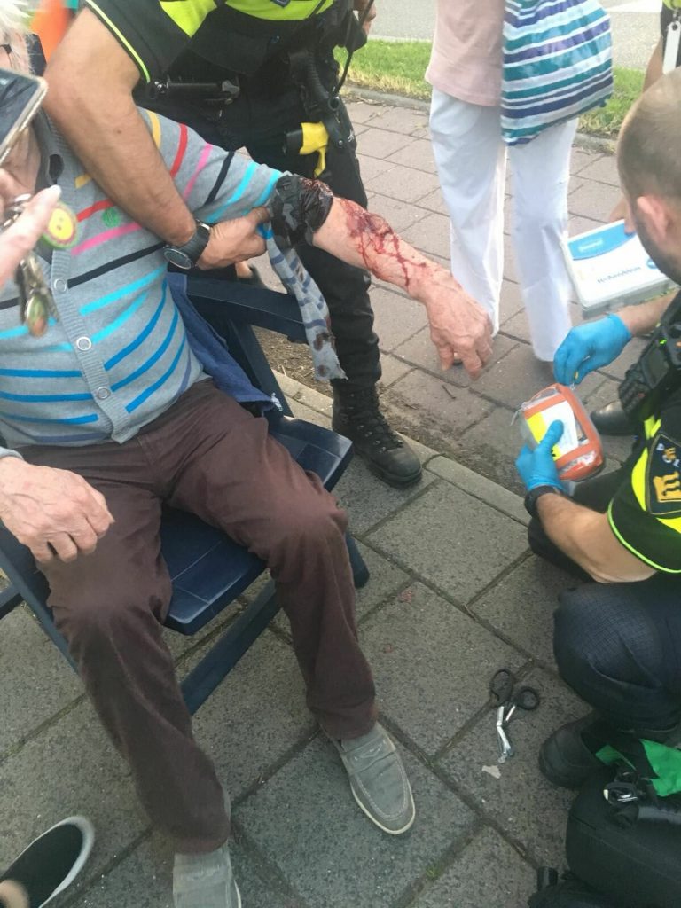 Man zwaargewond na beet van hond, hond en baas gevlucht Vondellaan Ridderkeek